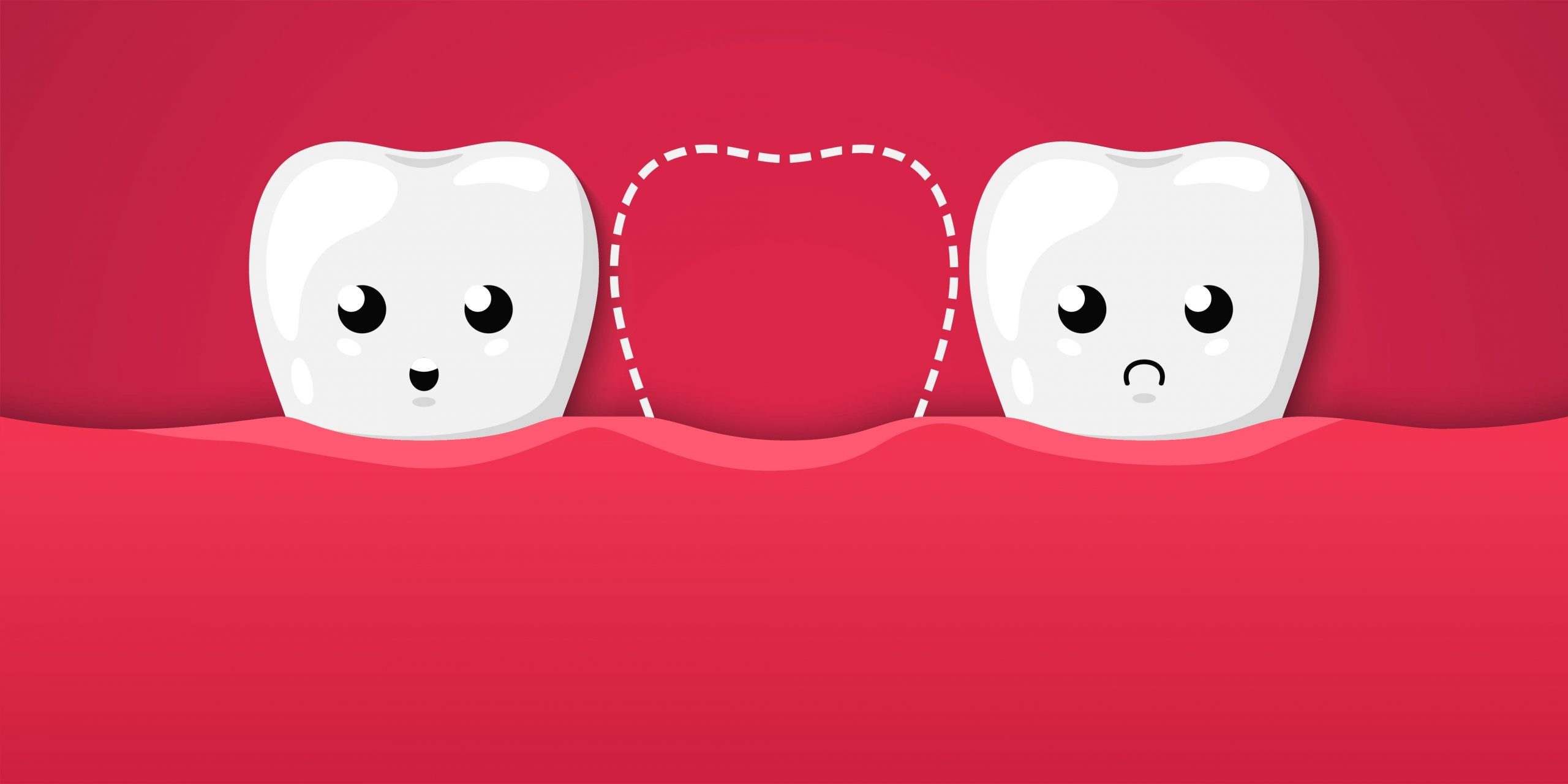 Une perte dentaire déséquilibre la dentition