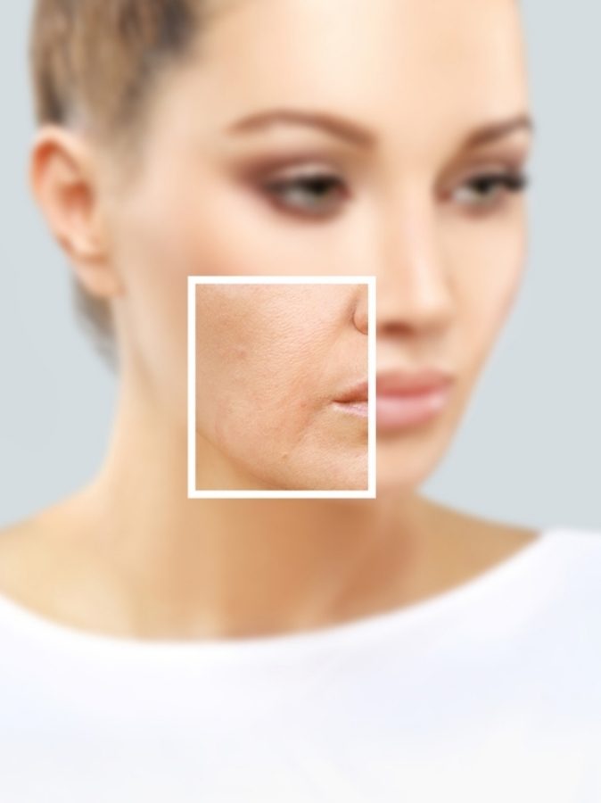 Pourquoi le volume du visage diminue-t-il avec l'âge ? Pourquoi le volume du visage diminue-t-il avec l'âge ?